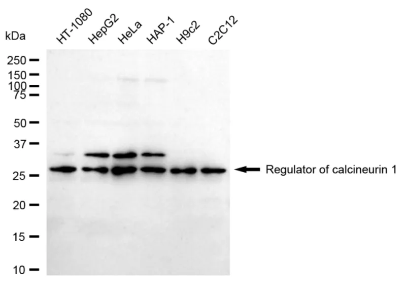 Sigma-Aldrich Anti Regulator Of Calcineurin 1 Antibody, clone 24GB1335, Rabbit Monoclonal,克隆24 GB 1335,重组兔单克隆,在HEK 293细胞中表达