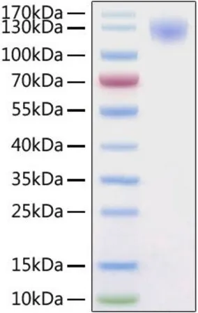 Sigma-Aldrich Recombinant 2019-nCoV Spike S1 Protein with His tag