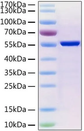 Sigma-Aldrich Recombinant 2019-nCoV Nucleocapsid Protein with His tag