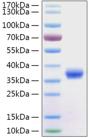 Sigma-Aldrich Recombinant 2019-nCoV Spike RBD Protein with His tag