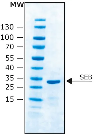 Sigma-Aldrich 葡萄球菌肠毒素B 来源于金黄色葡萄球菌
