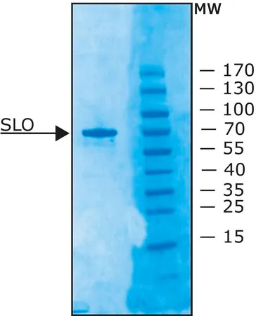 Sigma-Aldrich 链球菌溶血素O 来源于化脓链球菌,≥1,000,000单位/mg蛋白,重组,冻干粉,在大肠杆菌中表达