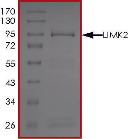 Sigma-Aldrich LIMK2, Active,PRECISIO®激酶,重组