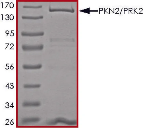 Sigma-Aldrich PKN2/PRK2, active, GST tagged human,PRECISIO®激酶,重组,在杆状病毒感染的Sf 9细胞中表达,≥70%(SDS-PAGE),甘油缓冲水溶液