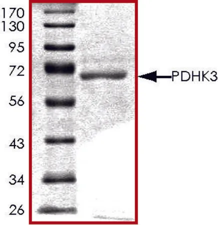 Sigma-Aldrich PDHK3, active, GST tagged human,PRECISIO®激酶,重组,在杆状病毒感染的Sf 9细胞中表达,≥70%(SDS-PAGE),甘油缓冲水溶液