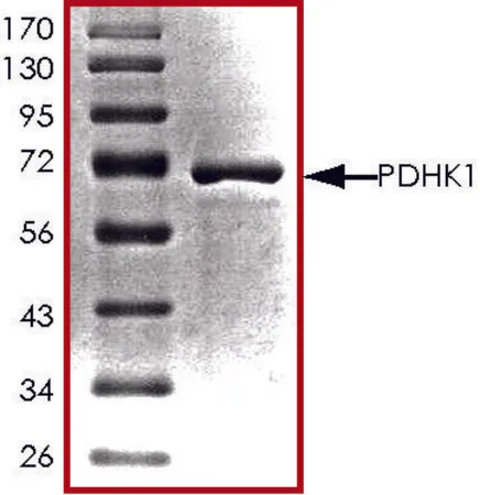 Sigma-Aldrich PDHK1, active, GST tagged human,PRECISIO®激酶,重组,在杆状病毒感染的Sf 9细胞中表达,≥70%(SDS-PAGE),甘油缓冲水溶液