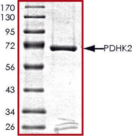 Sigma-Aldrich PDHK2, active, GST tagged human,PRECISIO®激酶,重组,在杆状病毒感染的Sf 9细胞中表达,≥70%(SDS-PAGE),甘油缓冲水溶液