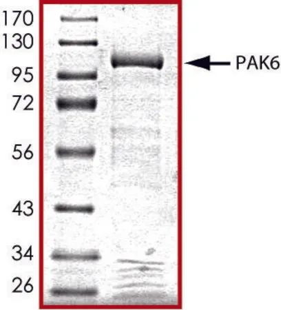 Sigma-Aldrich PAK6, active, GST tagged human,PRECISIO®激酶,重组,在杆状病毒感染的Sf 9细胞中表达,≥70%(SDS-PAGE),甘油缓冲水溶液