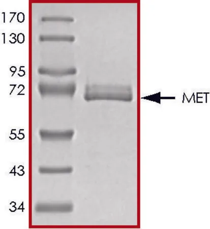 Sigma-Aldrich MET (958-end), active, GST tagged from rat,PRECISIO®激酶,重组,在杆状病毒感染的Sf 9细胞中表达,≥70%(SDS-PAGE),甘油缓冲水溶液