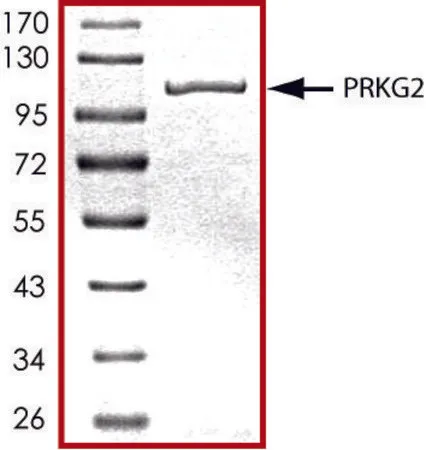 Sigma-Aldrich PRKG2, active, GST tagged human,PRECISIO®激酶,重组,在杆状病毒感染的Sf 9细胞中表达,≥70%(SDS-PAGE),甘油缓冲水溶液