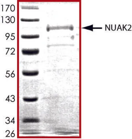 Sigma-Aldrich NUAK2, active, GST tagged human,PRECISIO®激酶,重组,在杆状病毒感染的Sf 9细胞中表达,≥70%(SDS-PAGE),甘油缓冲水溶液