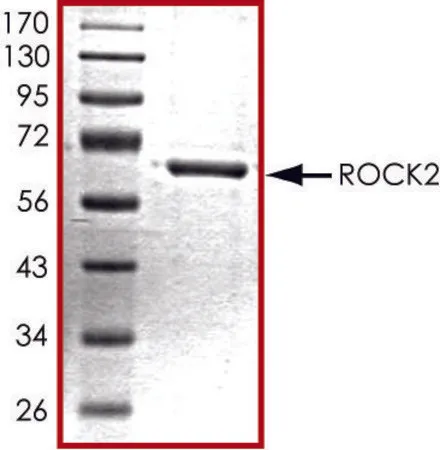 Sigma-Aldrich ROCK2 (5-554), active, His tagged human，PRECISIO®激酶，重组，在杆状病毒感染的Sf 9细胞中表达，≥70%（SDS-PAGE），甘油缓冲水溶液