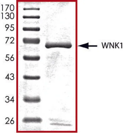 Sigma-Aldrich WNK1 (181-507), active, GST tagged human,PRECISIO®激酶,重组,在杆状病毒感染的Sf 9细胞中表达,≥70%(SDS-PAGE),甘油缓冲水溶液