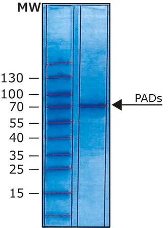 Sigma-Aldrich 4型肽基精氨酸脱亚胺酶,人重组体,在大肠杆菌中表达,水溶液