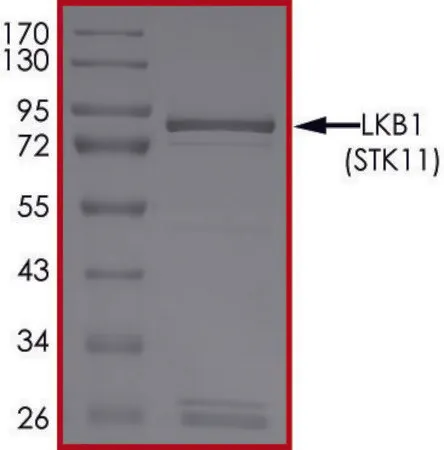Sigma-Aldrich LKB1(STK11) Protein,重组