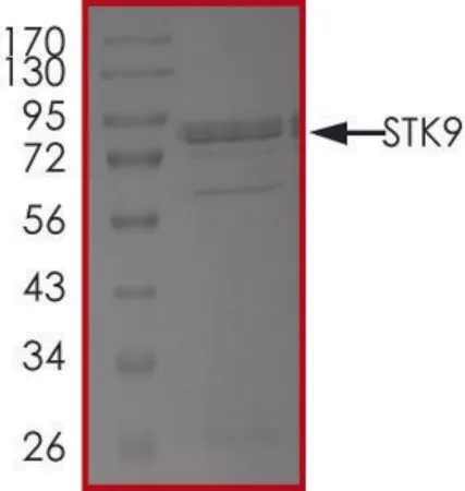 Sigma-Aldrich STK9 Protein,重组