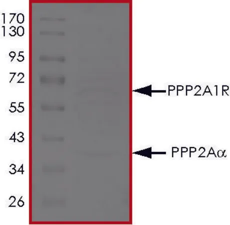 Sigma-Aldrich PP2A ALPHA/PPP2R1A Complex, Active，重组