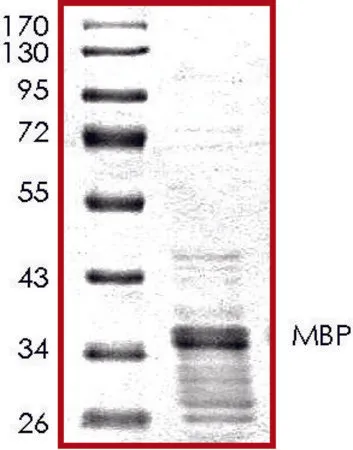 Sigma-Aldrich MBP, GST标记 人,重组体,在大肠杆菌中表达,≥65%(SDS-PAGE),甘油缓冲水溶液