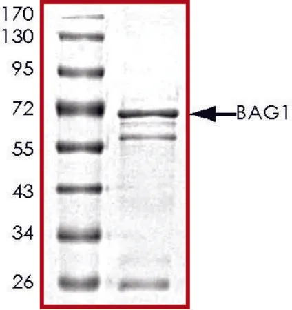 Sigma-Aldrich BAG1 (72-end), GST tagged human，重组体，在大肠杆菌中表达，≥70%（SDS-PAGE），甘油缓冲水溶液