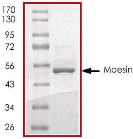 Sigma-Aldrich Moesin (410-end), GST tagged human,重组体,在大肠杆菌中表达,≥70%(SDS-PAGE),甘油缓冲水溶液