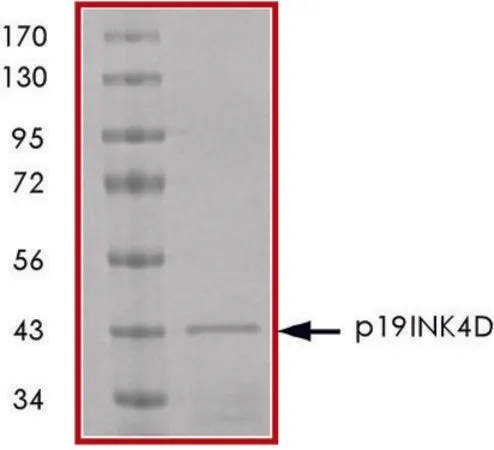 Sigma-Aldrich p19INK4D, GST tagged human,重组体,在大肠杆菌中表达,≥70%(SDS-PAGE),甘油缓冲水溶液