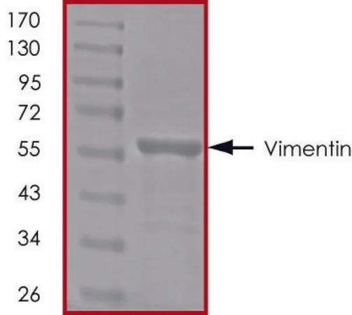 Sigma-Aldrich Vimentin, His tagged human,重组体,在大肠杆菌中表达,≥90%(SDS-PAGE),甘油缓冲水溶液