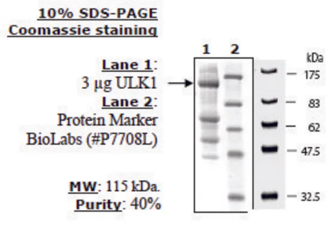 Sigma-Aldrich ULK Active human,重组体,在HEK 293细胞中表达,≥40%(SDS-PAGE)