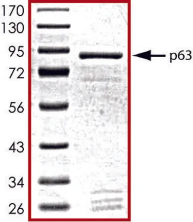 Sigma-Aldrich p63, GST tagged human,重组体,在杆状病毒感染的Sf 9细胞中表达,≥70%(SDS-PAGE),甘油缓冲水溶液