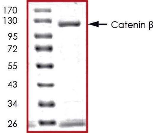 Sigma-Aldrich Catenin β, GST tagged human，重组体，在杆状病毒感染的Sf 9细胞中表达，≥70%（SDS-PAGE），甘油缓冲水溶液