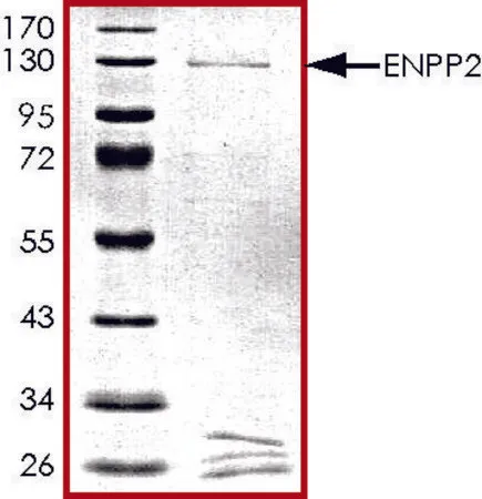 Sigma-Aldrich ENPP2, GST tagged human,重组体,在杆状病毒感染的Sf 9细胞中表达,≥70%(SDS-PAGE),甘油缓冲水溶液