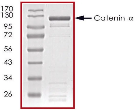 Sigma-Aldrich Catenin α, GST tagged human，重组体，在杆状病毒感染的Sf 9细胞中表达，≥70%（SDS-PAGE），甘油缓冲水溶液