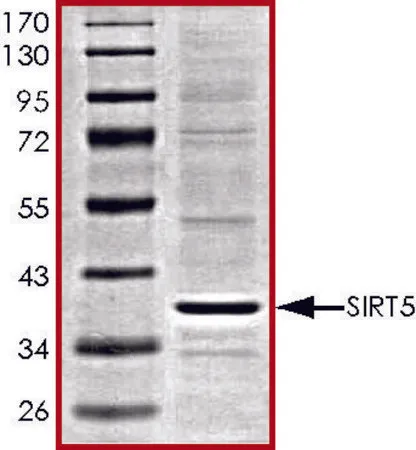 Sigma-Aldrich SIRT5,活性,His 标记 人,重组体,在杆状病毒感染的Sf 9细胞中表达,≥70%(SDS-PAGE),甘油缓冲水溶液