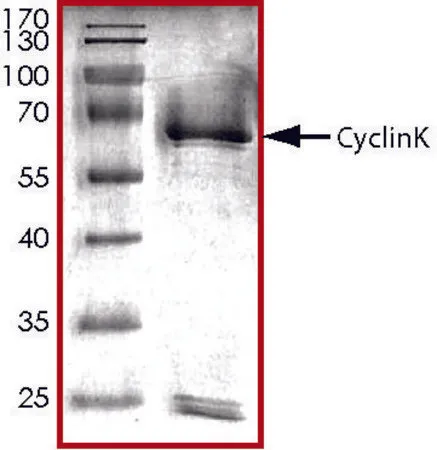 Sigma-Aldrich CyclinK, GST tagged human,重组体,在杆状病毒感染的Sf 9细胞中表达,≥70%(SDS-PAGE),甘油缓冲水溶液