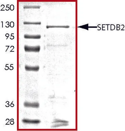 Sigma-Aldrich SETDB2, GST tagged human，重组体，在杆状病毒感染的Sf 9细胞中表达，≥70%（SDS-PAGE），甘油缓冲水溶液