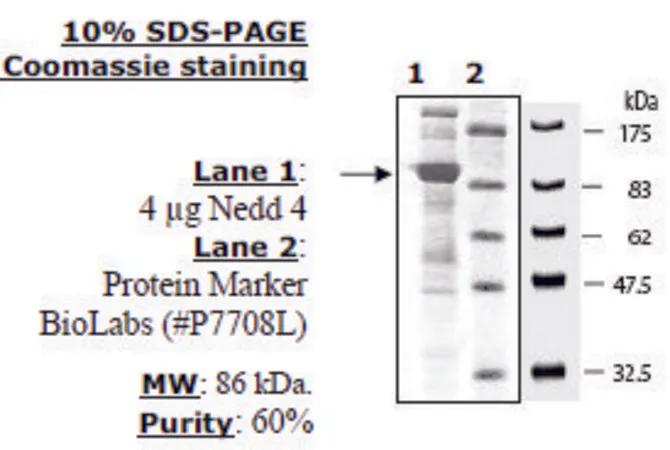 Sigma-Aldrich NEDD4 Active human,重组体,在杆状病毒感染的昆虫细胞中表达,≥60%(SDS-PAGE)
