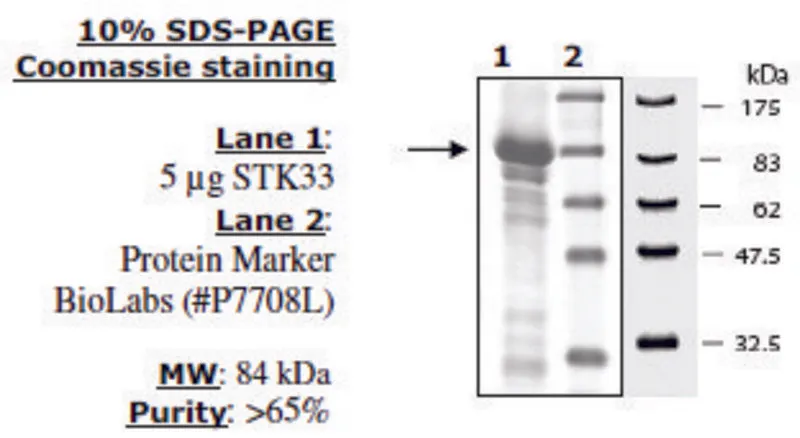 Sigma-Aldrich STK33 Active human,重组,在杆状病毒感染的昆虫细胞中表达,≥65%(SDS-PAGE)