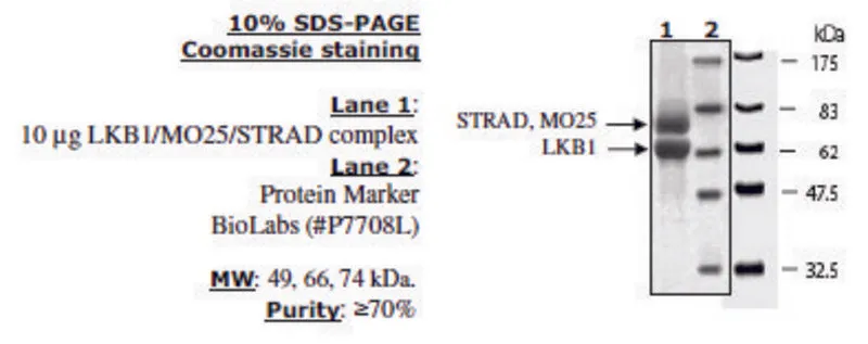 Sigma-Aldrich LKB1/MO25/STRAD Active human,重组,在杆状病毒感染的昆虫细胞中表达,≥70%(SDS-PAGE)