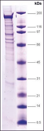 Sigma-Aldrich BRG1, wild type human,重组体,在昆虫细胞中表达,≥80%(SDS-PAGE)