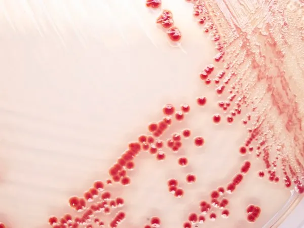 默克密理博 Acinetobacter Millichrome™ plus Supplement,适用于微生物学